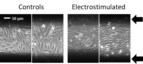 Effect of Electrostimulation of Endothelial Cells
