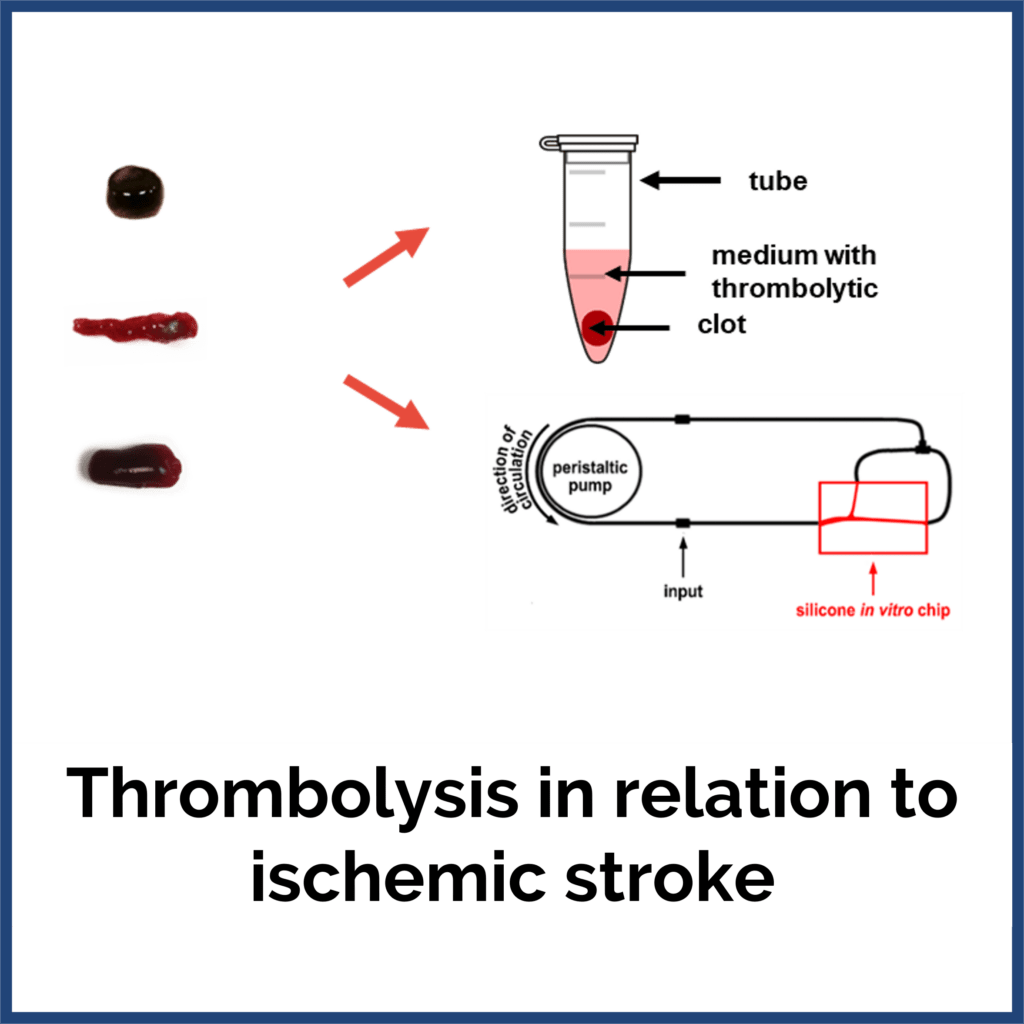 Thrombolysis logo